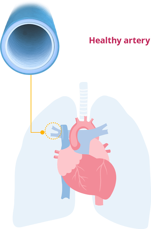 Healthy lung artery
