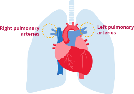 Right and left pulmonary arteries