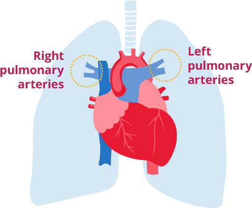 Right and left pulmonary arteries