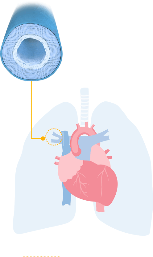 Long view of lungs with healthy arteries